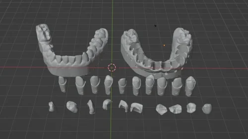 3D Моделювання Та Візуалізація – Хірургія Та Медицина 3d моделювання та візуалізація - хірургія та медицина