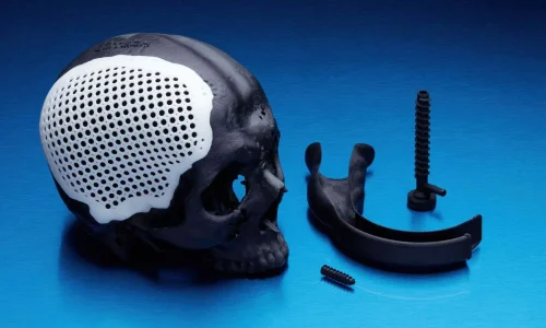 Послуги 3D-Друку – Хірургічні Гайди Послуги 3d-друку - хірургічні гайди
